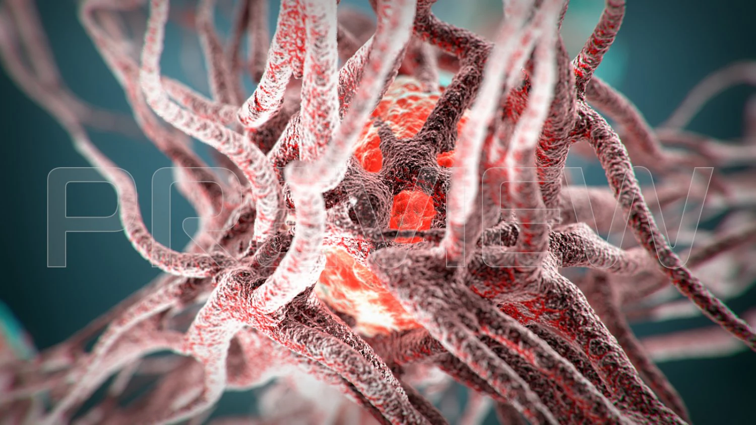 cancro statico Modello 3D .c4d .max .obj .3ds .fbx .stl .blend 