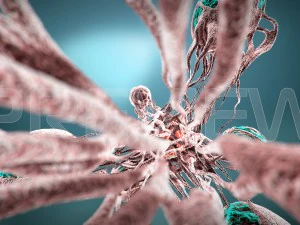 cancro statico Modello 3D