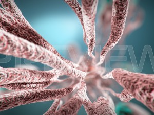 static cancer 3D 모델