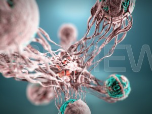 static cancer 3D 모델