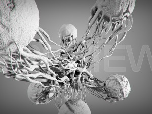 static cancer 3D 모델