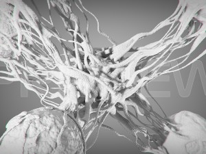 static cancer 3D 모델