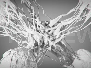 cancro statico Modello 3D