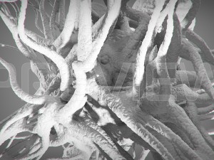 static cancer 3D 모델
