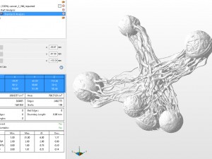cancer stl model 3D-Druckmodell
