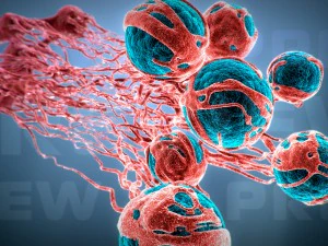 cancer growth 2 static hipoly 3D Model