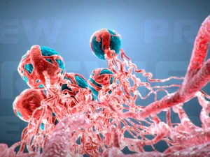 cancer growth 2 static hipoly 3D Model