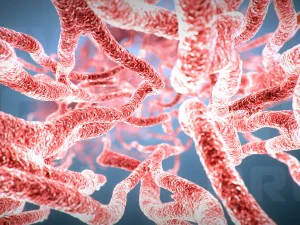 cancer growth 2 static hipoly 3D Model