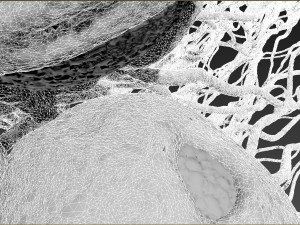 cancer growth 2 static hipoly 3D Модель