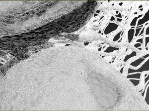 cancer growth 2 static hipoly 3D Model