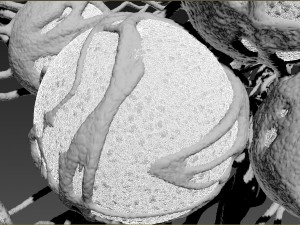 cancer growth 2 static hipoly 3D Модель