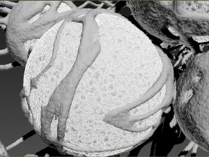 cancer growth 2 static hipoly 3D Model