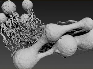 cancer growth 2 static hipoly 3D Model