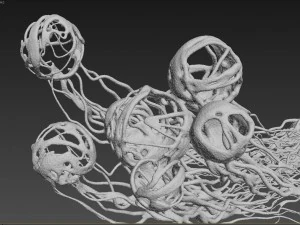 cancer growth 2 static hipoly 3D Model