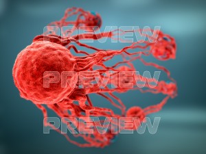cancer growth static 3 3D Model