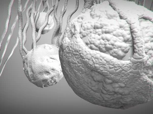 cancer growth static 3 3D Model