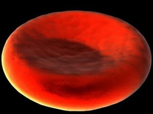 blood cells sickle anemia also Modèle 3D