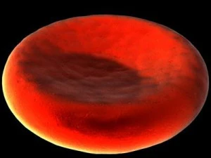 blood cells sickle anemia also 3D Model
