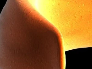 blood cells sickle anemia also 3D Model