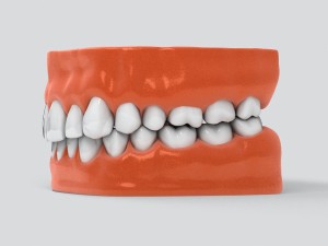 human teeth 3D 모델