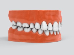 human teeth 3D 모델