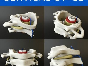 vertebrae c1 c2 cervical spine bones Model 3D