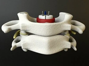 vertebrae c1 c2 cervical spine bones 3D Model
