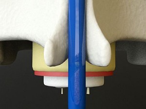 vertebrae c1 c2 cervical spine bones Model 3D