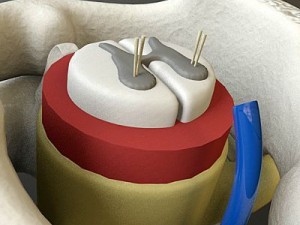 vertebrae c1 c2 cervical spine bones Model 3D