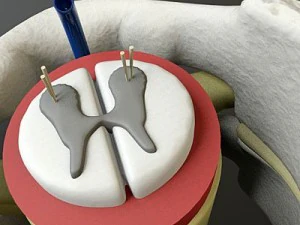 vertebrae c1 c2 cervical spine bones 3D Model