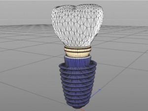 dental implant 3D Model