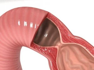 realistic stomach with cutaway 3D Model