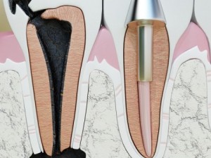 teeth pathologies high detail 3D Модель