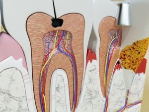 teeth pathologies high detail 3D Модель