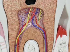 teeth pathologies high detail 3D Model