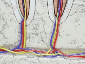 teeth pathologies high detail 3D Модель