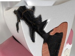 decayed tooth 3Dモデル