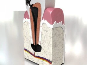 decayed tooth 3D Model