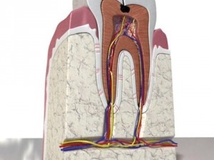 cracked tooth high detail Modelo 3D