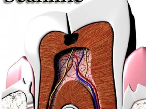 cracked tooth high detail 3D Model