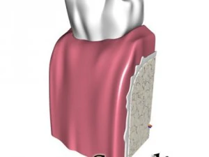 cracked tooth high detail 3D Model