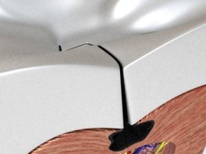 cracked tooth high detail Modèle 3D