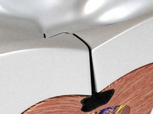 cracked tooth high detail 3D Model