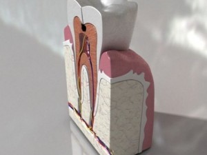 cracked tooth high detail Modèle 3D
