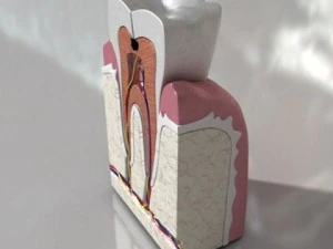 cracked tooth high detail 3D Model