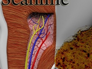 tooth dental plaque high detail 3D 모델