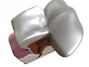 tooth dental plaque high detail 3D Model