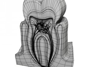 tooth  gum cross section 3D Model