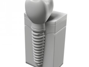 dental implant Modelo 3D