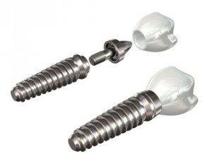 dental implant Modelo 3D